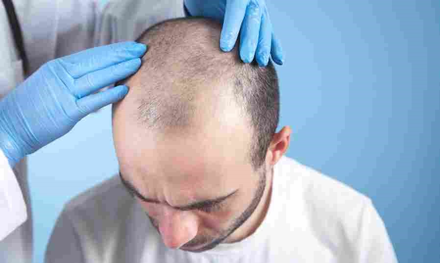 Transform Your Hairline with a Hair Transplant UK Procedure